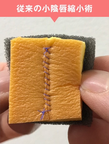 しょういんしん 縮小