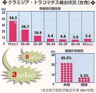 女子 クラミジア おりもの 写真