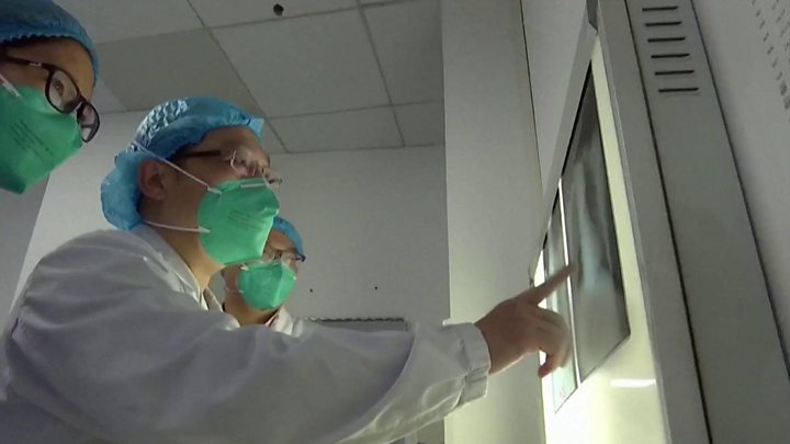 コロナ 目 が 腫れる