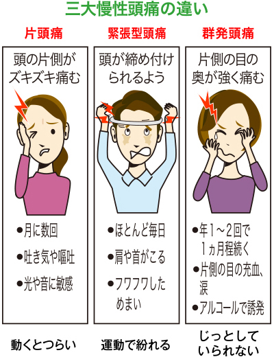 片頭痛 予防 サプリメント