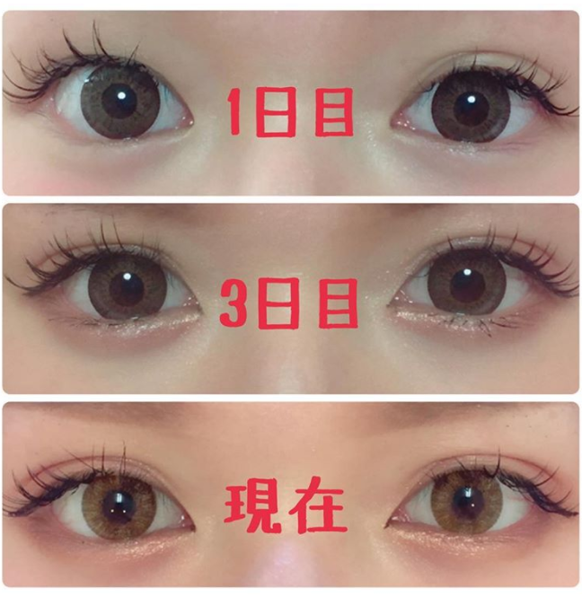 ナイト アイ ボーテ