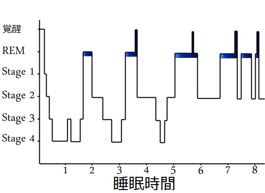 ノンレム 睡眠 と は