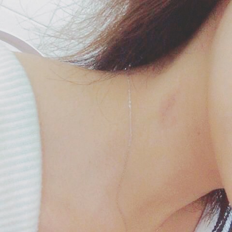 キスマーク つけかた