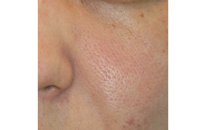 毛穴 に 効く 化粧 水