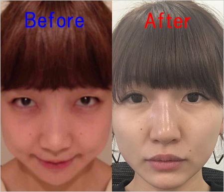 桃ブログ したらば